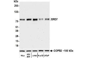 Western Blotting (WB) image for anti-Bromodomain Containing 7 (BRD7) (AA 150-200) antibody (ABIN7449350)