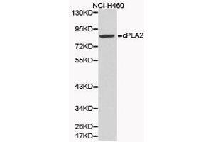 Western Blotting (WB) image for anti-Phospholipase A2, Group IVA (Cytosolic, Calcium-Dependent) (PLA2G4A) antibody (ABIN1874154) (PLA2G4A 抗体)