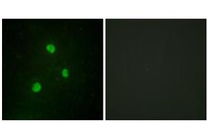 Immunofluorescence analysis of A549 cells, using TBX1 antibody. (T-Box 1 抗体  (C-Term))