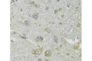 Immunohistochemistry of paraffin-embedded Mouse brain using CRYM Polyclonal Antibody at dilution of 1:100 (40x lens). (CRYM 抗体)