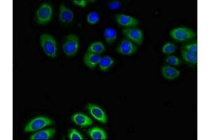 Immunofluorescent analysis of A549 cells using ABIN7153347 at dilution of 1:100 and Alexa Fluor 488-congugated AffiniPure Goat Anti-Rabbit IgG(H+L) (GPR4 抗体  (AA 285-362))