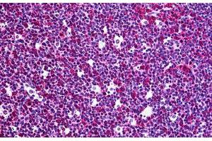 Human Tonsil: Formalin-Fixed, Paraffin-Embedded (FFPE) (RGS3 抗体  (AA 1-193))