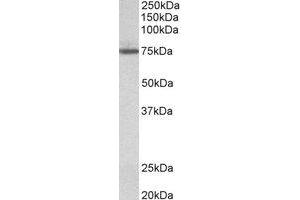 Western Blotting (WB) image for anti-Transglutaminase 4 (Prostate) (TGM4) (Internal Region) antibody (ABIN2464954)