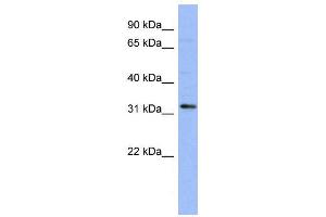 WB Suggested Anti-TLX1  Antibody Titration: 0. (TLX1 抗体  (N-Term))