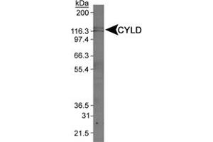 Western blot analysis of CYLD in Jurkat whole cell extract using CYLD polyclonal antibody . (CYLD 抗体  (AA 500-600))