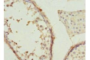 Immunohistochemistry of paraffin-embedded human testis tissue using ABIN7171416 at dilution of 1:100 (CCT2 抗体  (AA 206-535))