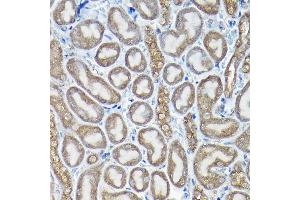Immunohistochemistry of paraffin-embedded rat testis using PIWIL4 Rabbit pAb (ABIN6132982, ABIN6145704, ABIN6145705 and ABIN6217111) at dilution of 1:100 (40x lens). (PIWIL4 抗体  (AA 260-460))