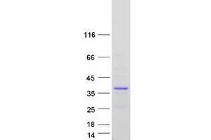 Western Blotting (WB) image for Family with Sequence Similarity 110, Member A (FAM110A) (Transcript Variant 3) protein (Myc-DYKDDDDK Tag) (ABIN2720730)