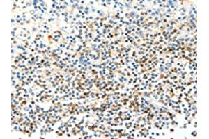 The image on the left is immunohistochemistry of paraffin-embedded Human tonsil tissue using ABIN7129442(FAM3A Antibody) at dilution 1/25, on the right is treated with fusion protein. (FAM3A 抗体)