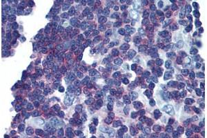 Human Thymus (formalin-fixed, paraffin-embedded) stained with LAT antibody ABIN293627 at 10 ug/ml followed by biotinylated anti-mouse IgG secondary antibody ABIN481714, alkaline phosphatase-streptavidin and chromogen. (LAT 抗体  (Cytoplasmic Domain))