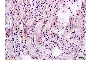 Formalin-fixed and paraffin embedded rat kidney tissue labeled Anti-MRP1 Polyclonal Antibody, Unconjugated (ABIN671526) at 1:200, followed by conjugation to the secondary antibody and DAB staining (MRP1 抗体  (AA 501-600))