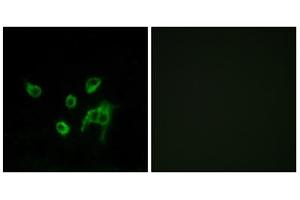 Immunofluorescence analysis of COS-7 cells, using WNT1 antibody. (WNT1 抗体  (C-Term))