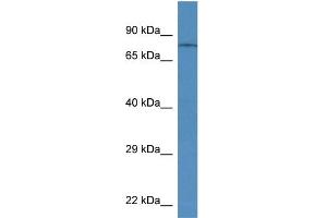 Western Blotting (WB) image for anti-Transient Receptor Potential Cation Channel, Subfamily V, Member 6 (TRPV6) (Middle Region) antibody (ABIN2776225)