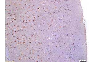 Formalin-fixed and paraffin embedded rat brain labeled with Anti-Glutamine PRPP amidotransferase Polyclonal Antibody, Unconjugated (ABIN872980) at 1:200 followed by conjugation to the secondary antibody and DAB staining (PPAT 抗体  (AA 351-430))