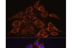 Immunofluorescence analysis of C6 cells using HPS4 Polyclonal Antibody at dilution of 1:100. (HPS4 抗体)