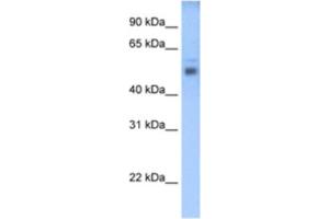 Western Blotting (WB) image for anti-STEAP Family Member 3, Metalloreductase (STEAP3) antibody (ABIN2462703) (STEAP3 抗体)