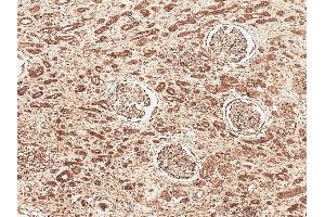 Immunohistochemistry analysis using Rabbit Anti-FNP1 Polyclonal Antibody (ABIN5066850).