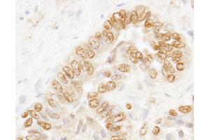 Immunohistochemistry (IHC) image for anti-Cleavage Stimulation Factor, 3' Pre-RNA, Subunit 3, 77kDa (CSTF3) (AA 1-50) antibody (ABIN7453682)