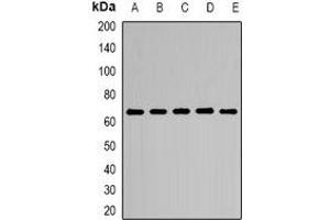 Western blot analysis of CD299 expression in HEK293T (A), Hela (B), NIH3T3 (C), mouse lung (D), mouse heart (E) whole cell lysates. (C-Type Lectin Domain Family 4, Member M (CLEC4M) 抗体)