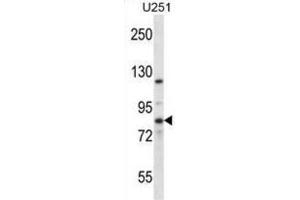 Western Blotting (WB) image for anti-Eukaryotic Translation Initiation Factor 2B, Subunit 5 Epsilon, 82kDa (EIF2B5) antibody (ABIN2997136)