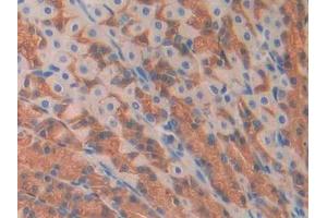 Immunohistochemistry (IHC) image for anti-Myostatin (MSTN) (AA 267-376) antibody (ABIN1174892)