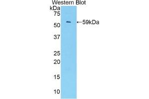 Detection of Recombinant IRF1, Mouse using Polyclonal Antibody to Interferon Regulatory Factor 1 (IRF1) (IRF1 抗体  (AA 44-319))