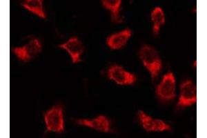 ABIN6269341 staining 293 by IF/ICC. (Acetyl-CoA Carboxylase alpha 抗体  (N-Term))