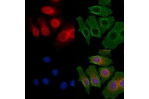 ABIN6263616 and ABIN6268641 staining HepG2 cells by IF/ICC.