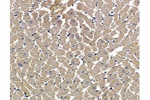 ABIN7097103 and ABIN7101170 at 1/100 staining rat heart tissue by IHC-P. (Dolichol Kinase 抗体)
