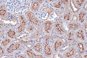 Immunohistochemistry of paraffin-embedded rat kidney using Xanthine Oxidase (XDH) (XDH) Rabbit mAb (ABIN7271408) at dilution of 1:100 (40x lens).