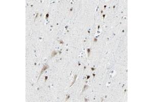 Immunohistochemical staining of human cerebral cortex with RDBP polyclonal antibody  shows strong nuclear positivity in neuronal cells at 1:200-1:500 dilution. (RDBP 抗体)