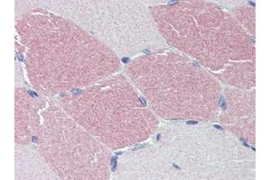 Human Skeletal Muscle: Formalin-Fixed, Paraffin-Embedded (FFPE) (STK39 抗体  (C-Term))