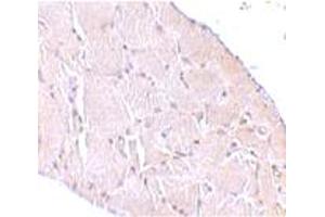 Immunohistochemical staining of human skeletal muscle tissue with 10 ug/mL WNT10A polyclonal antibody . (WNT10A 抗体  (C-Term))