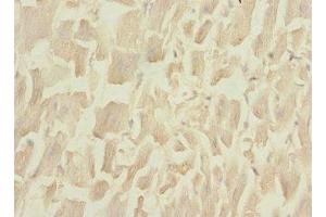 Immunohistochemistry of paraffin-embedded human heart tissue using ABIN7149412 at dilution of 1:100 (PLA2G4C 抗体  (AA 1-189))