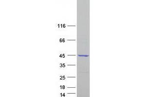 Western Blotting (WB) image for Organic Solute Carrier Partner 1 (OSCP1) (Transcript Variant 1) protein (Myc-DYKDDDDK Tag) (ABIN2728000)