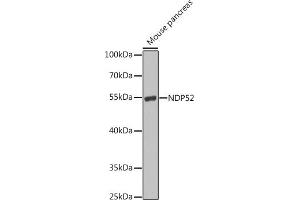 Western blot analysis of extracts of mouse pancreas, using NDP52 antibody (ABIN6131368, ABIN6137860, ABIN6137861 and ABIN6223210) at 1:1000 dilution. (CALCOCO2 抗体  (AA 137-446))