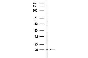Western blot analysis of lysates from HepG2 cells(LPS,4h treatment), using NDUFS5 Antibody at 1/1000 dilution.