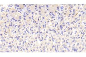 Detection of NT in Mouse Stomach Tissue using Polyclonal Antibody to Neurotensin (NT) (Neurotensin 抗体  (AA 42-167))