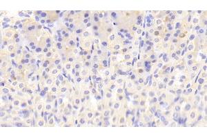 Detection of NT in Mouse Stomach Tissue using Polyclonal Antibody to Neurotensin (NT) (Neurotensin 抗体  (AA 42-167))