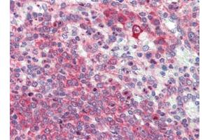 Human Spleen (formalin-fixed, paraffin-embedded) stained with LXNfollowed by biotinylated goat anti-rabbit IgG secondary antibody, alkaline phosphatase-streptavidin and chromogen. (Latexin 抗体  (Center))