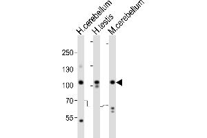 Western blot analysis of lysates from human cerebellum, human testis, mouse cerebellum tissue lysate (from left to right), using SKOR2 Antibody (C-term) (ABIN6244147 and ABIN6577773).