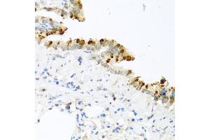 Immunohistochemistry of paraffin-embedded mouse lung using BMP4 antibody (ABIN6127497, ABIN6137600, ABIN6137603 and ABIN6215157) at dilution of 1:100 (40x lens).