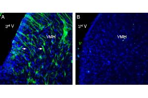 Expression of GPR139 in rat ventromedial hypothalamus (VMH). (G Protein-Coupled Receptor 139 (GPR139) Peptide)