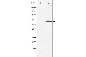 Western blot analysis of ZAP-70 phosphorylation expression in Jurkat whole cell lysates,The lane on the left is treated with the antigen-specific peptide. (ZAP70 抗体  (pTyr493))