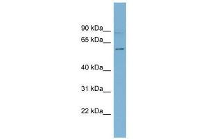 Western Blot showing HSF5 antibody used at a concentration of 1-2 ug/ml to detect its target protein. (HSF5 抗体  (Middle Region))