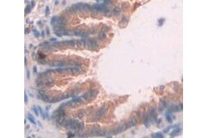 IHC-P analysis of Rat Tissue, with DAB staining. (CXCL11 抗体  (AA 22-100))