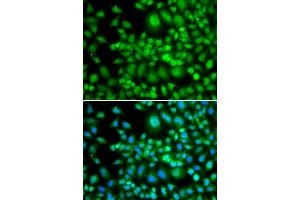 Immunofluorescence analysis of MCF-7 cells using SETD5 antibody (ABIN4905135). (SETD5 抗体)