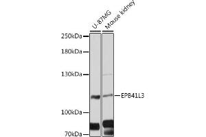 Western blot analysis of extracts of various cell lines, using EPB41L3 antibody (ABIN6127807, ABIN6140201, ABIN6140202 and ABIN6216501) at 1:3000 dilution. (EPB41L3 抗体  (AA 656-865))