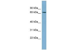 WB Suggested Anti-CACNB2 Antibody Titration:  0.