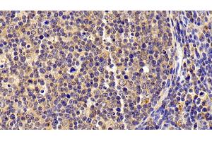 Detection of S100A8 in Porcine Lymph node Tissue using Polyclonal Antibody to S100 Calcium Binding Protein A8 (S100A8) (S100A8 抗体  (AA 1-89))